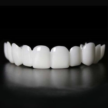 Removable Resin Full-Arch Snap-On Veneers